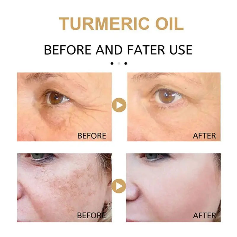 Turmeric Freckle Whitening Serum