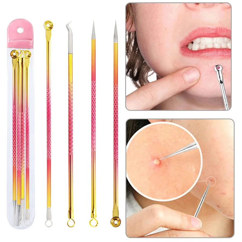 4pcs-blackhead-remover-extractor-tool.jpg