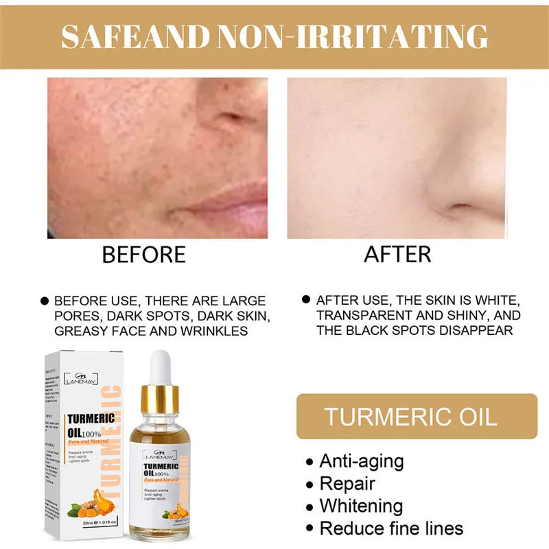 Turmeric Freckle Whitening Serum