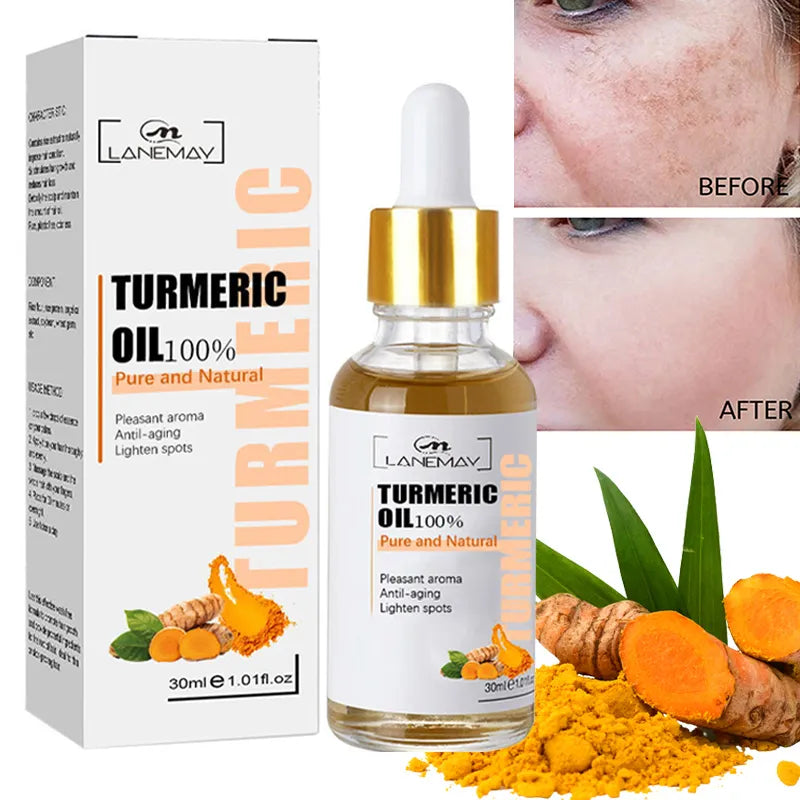 turmeric-freckle-whitening-serum.jpg