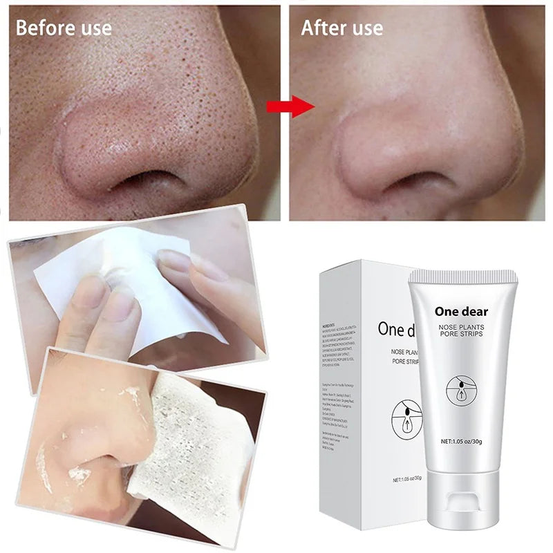 blackhead-remover-nose-mask.jpg
