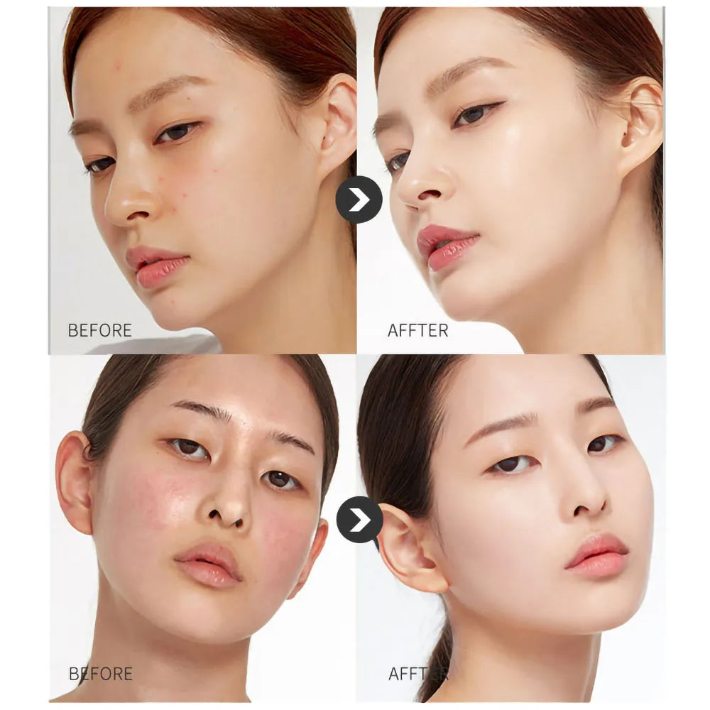 Oil Control Unclog Pores Facial Cleanser