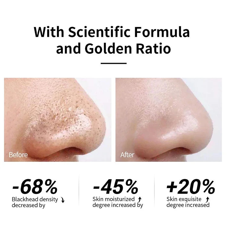 Blackhead Remover Nose Mask